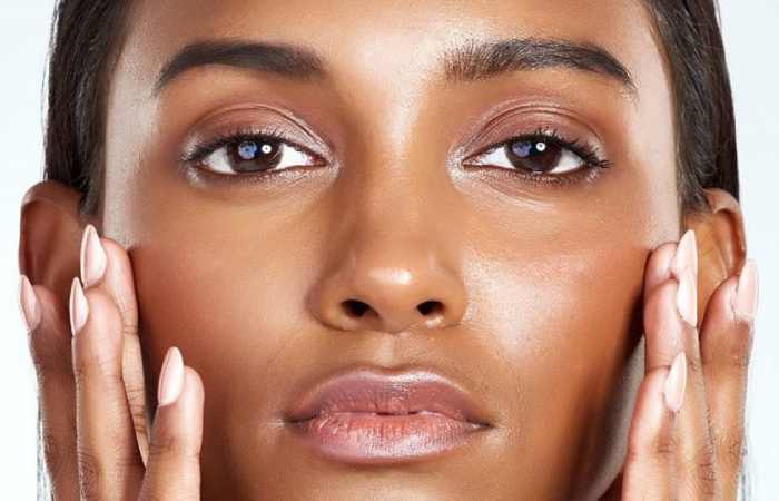 what are oily eyelids