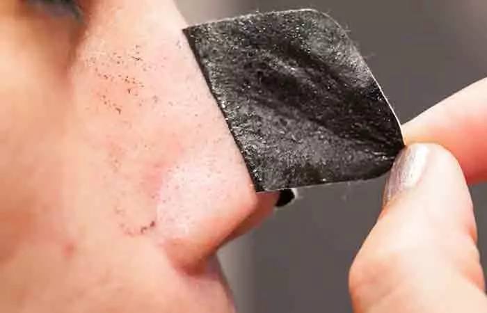 What is a homemade blackhead strip