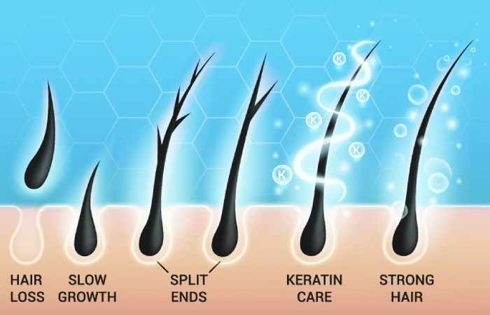 weak hair roots and hair fall