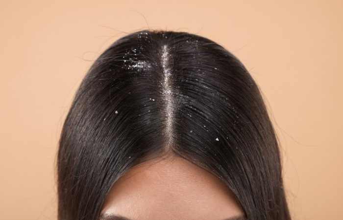 What exactly is hair buildup_