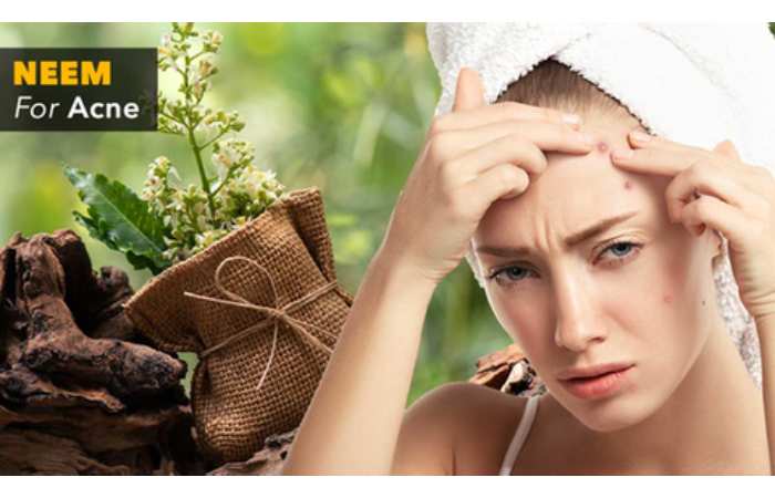 Why Neem Paste Is Effective for Acne