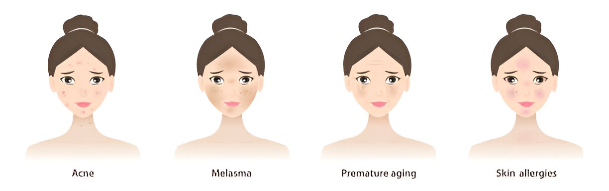 Types of Dark Spots
