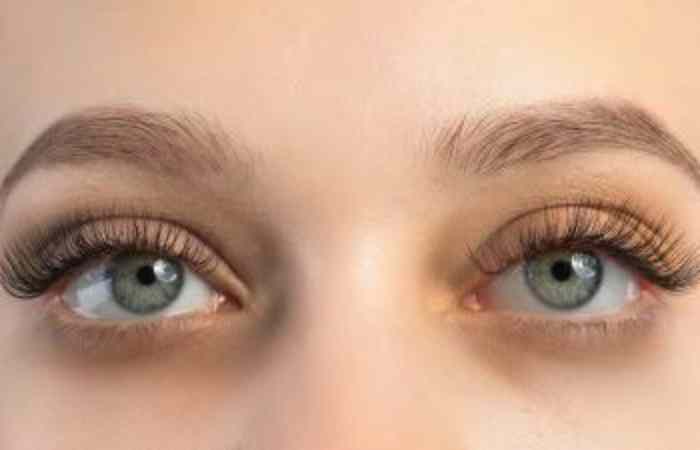 what are dark circles