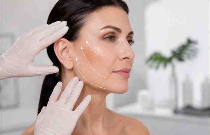 what Is a full facelift
