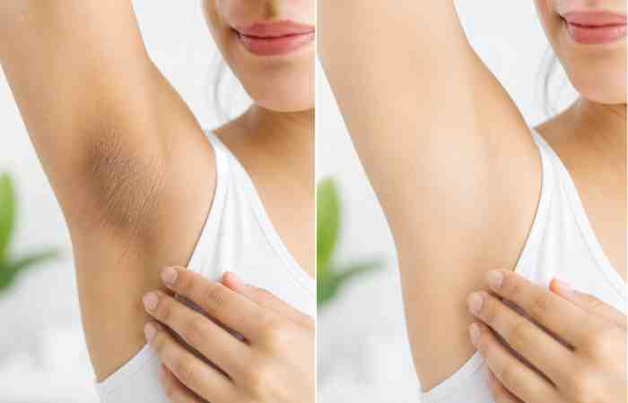 what does “clear underarms” mean