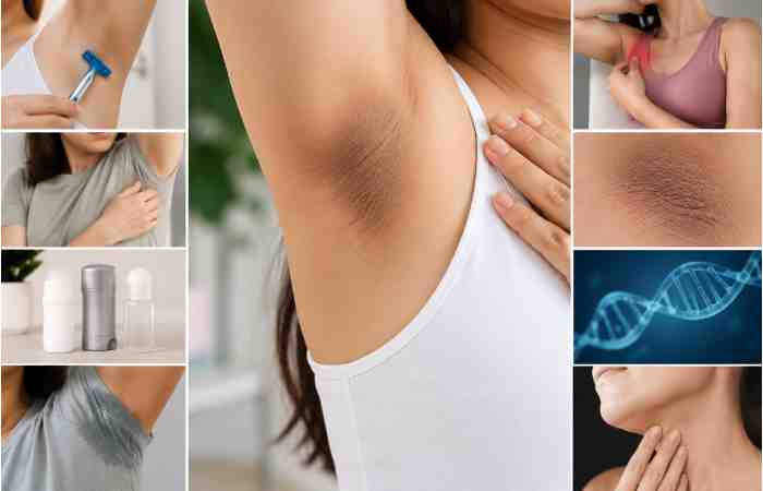 why do underarms become dark or uneven